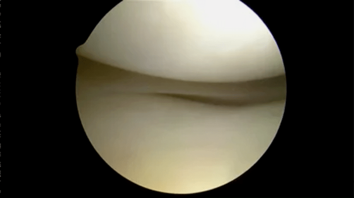 astroscopic view of completely healthy surfaces